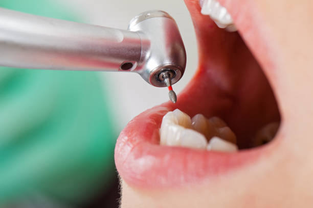 Best Pediatric Emergency Dentist in Severn, MD